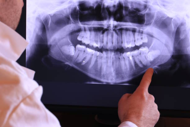 Best Root Canal Emergency Dentist  in Westville, NJ